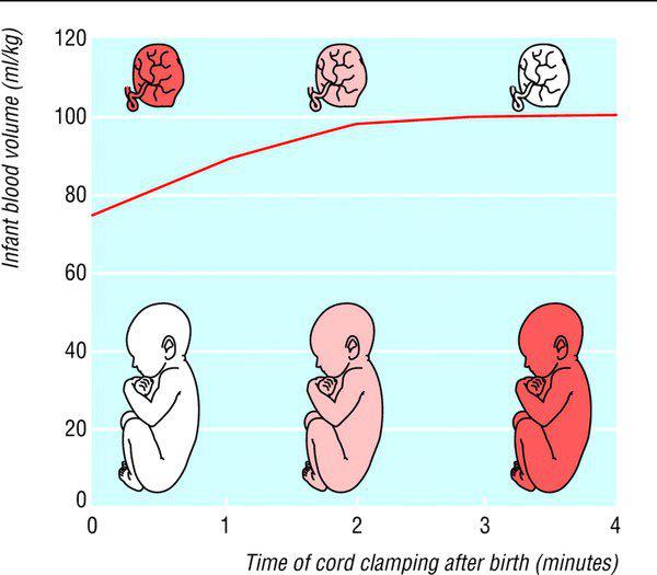 Courtesy of cord clamping.com